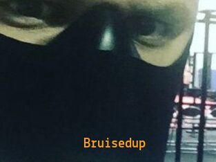 Bruisedup